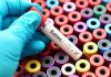 test tube with rabies written on it