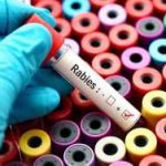 test tube with rabies written on it