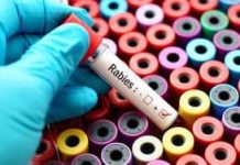 test tube with rabies written on it