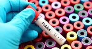 test tube with rabies written on it