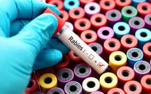 rabies-know-the-facts-300x188.jpg test tube with rabies written on it