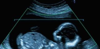 CDC Flying Blind on Abortion Computer monitor with analytics dashboard in a modern open office