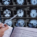 A Worm No Doctor Had Ever Seen in a Human Person analyzing brain MRI images with a pen.