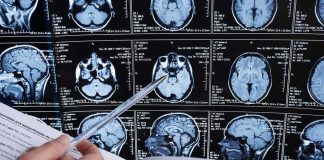 Person analyzing brain MRI images with a pen.